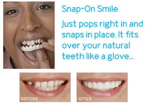 Snap On Smile